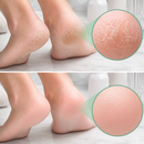 Meias de Silicone com Gel | 7 Benefícios para Hidratar os Pés