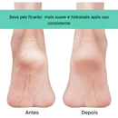 Meias de Silicone Gel Par Hidratação Esfoliação Pés Rachados ou Ressecados de Pés Meia Pele Seca